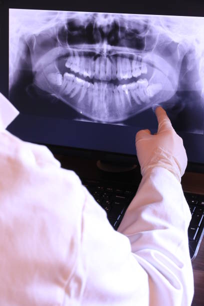 Best Emergency Dentist for Knocked-Out Tooth in Valinda, CA